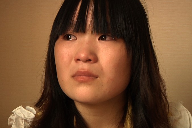 Cô Shang Jiaojiao, 17 tuổi, bắt đầu làm việc ở một nhà máy để phụ giúp cha mẹ nghèo khổ.  Sau khi lau chùi nhiều màn hình điện tử bằng n-hexane, cô bị tổn hại thần kinh nghiêm trọng và không còn đi lại được nữa (Ảnh của tổ chức Theo dõi Nhân quyền Human Rights Watch)