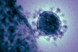 virus corona noi chung