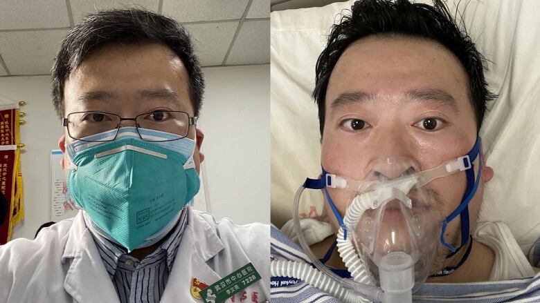 Bác sĩ LiWenliang điều trị nhiễm virus corona mới.