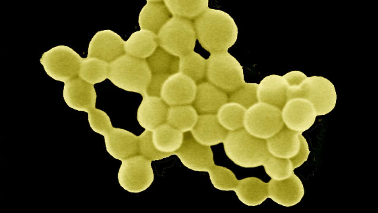vi khuẩn kim loại thành vàng