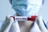 Phat hien Virus Ebola co the an minh 5 6 nam trong co the benh nhan da khoi benh 1