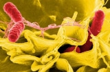 CDC My Vi khuan Salmonella khong ro nguon goc lan rong ra 29 tieu bang 1
