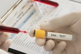 xét nghiệm ADN