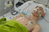 Nam sinh lớp 8 ở Hà Nội bị đánh chấn thương sọ não tử vong