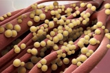 Hiểu rõ về loại vi khuẩn này có thể giúp bạn ngăn ngừa ngộ độc thực phẩm